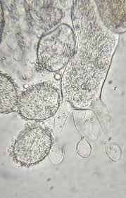 Attēlu rezultāti vaicājumam “Aleurodiscus amorphus”