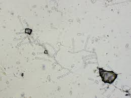 Attēlu rezultāti vaicājumam “Erysiphe galeopsidis”