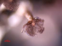 Attēlu rezultāti vaicājumam “Diachea muscorum spores”