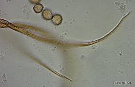 Attēlu rezultāti vaicājumam “Trichia crateriformis”