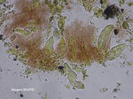 Attēlu rezultāti vaicājumam “Verrucaria hydrela”