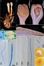 Attēlu rezultāti vaicājumam “Heterotrichia insignis (syn. Arcyria insignis)”