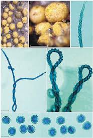 Attēlu rezultāti vaicājumam “Trichia varia”