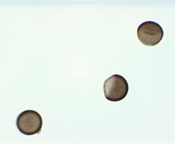 Attēlu rezultāti vaicājumam “Licea pusilla”