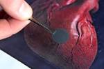 Researchers create nanopatch for the heart | Brown University News ...