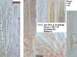 Attēlu rezultāti vaicājumam “Myriosclerotinia scirpicola”