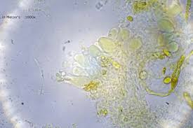 Attēlu rezultāti vaicājumam “Basidiodendron”