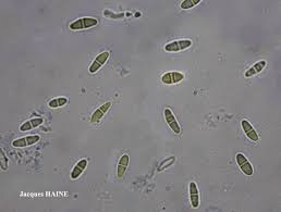 Attēlu rezultāti vaicājumam “Cliostomum corrugatum”