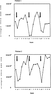 Image result for Autopheresis C