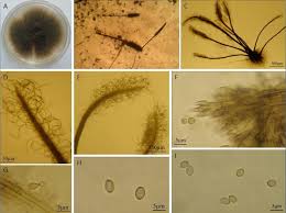 Attēlu rezultāti vaicājumam “Trichia longipalpis spores”
