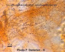 Attēlu rezultāti vaicājumam “Lycogala persicum spores”