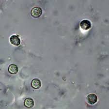 Attēlu rezultāti vaicājumam “Ceratiomyxa porioides spores”