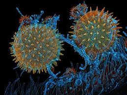 Attēlu rezultāti vaicājumam “Arcyria imperialis spores”