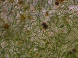 Attēlu rezultāti vaicājumam “Nostoc pruniforme cells”