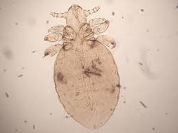 Attēlu rezultāti vaicājumam “Licea pygmaea sessile”