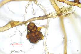 Attēlu rezultāti vaicājumam “Tortula truncata sporophyte”