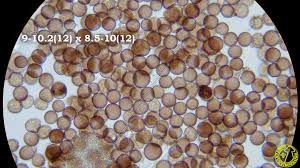 Attēlu rezultāti vaicājumam “Physarum bivalve spores”
