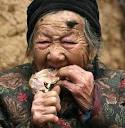 Woman grows 6cm horn on