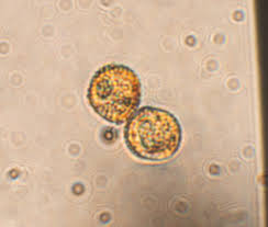 Attēlu rezultāti vaicājumam “Metatrichia vesparia spores”