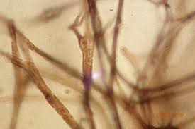 Attēlu rezultāti vaicājumam “Lamproderma puncticulatum macro”