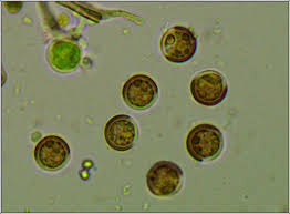 Attēlu rezultāti vaicājumam “Licea pusilla spores”