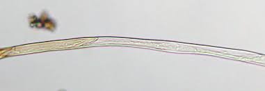 Attēlu rezultāti vaicājumam “Grimmia pulvinata sporophyte”