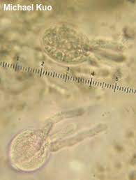 Attēlu rezultāti vaicājumam “Tremella mesenterica”