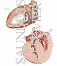 <b>Endocardial Fibroelastosis</b> and
