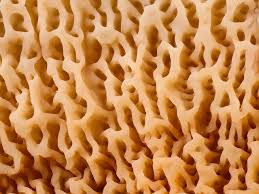 Attēlu rezultāti vaicājumam “Phlebia tremellosa”