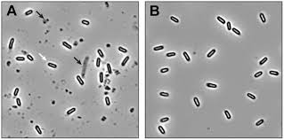 Attēlu rezultāti vaicājumam “Enteridium variabile spores”