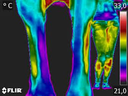 Image result for thermographie-aufnahmen