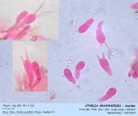 Attēlu rezultāti vaicājumam “Athelia arachnoidea”