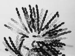 Attēlu rezultāti vaicājumam “Sordaria fimicola”