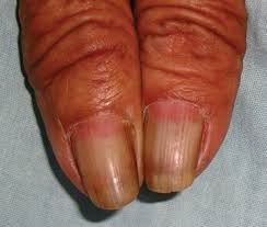 Image result for lunula nail