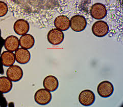 Attēlu rezultāti vaicājumam “Physarum bryomacrocarpum spores”