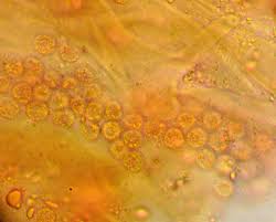 Attēlu rezultāti vaicājumam “Lycogala roseosporum sessile”