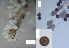 Attēlu rezultāti vaicājumam “Didymium annulisporum spores”