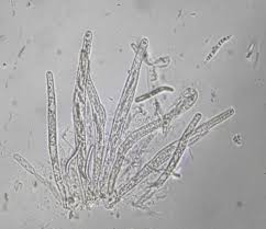 Attēlu rezultāti vaicājumam “Lasiosphaeria ovina”