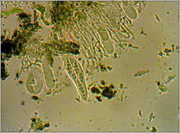 Attēlu rezultāti vaicājumam “Opegrapha atra”