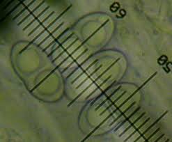 Attēlu rezultāti vaicājumam “Megalaria grossa”