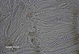 Attēlu rezultāti vaicājumam “Thelotrema lepadinum”