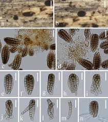 Attēlu rezultāti vaicājumam “Diachea dictyospora (syn. Craterium dictyosporum) spores”