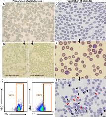 Attēlu rezultāti vaicājumam “Reticularia lobata plasmodium”