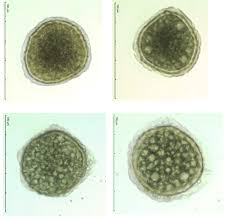 Attēlu rezultāti vaicājumam “Riccia sorocarpa macro”