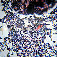 Gram-positive bacteria - Wikipedia, the free encyclopedia