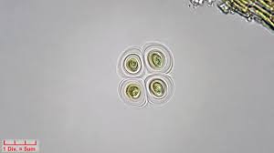 Attēlu rezultāti vaicājumam “Gloeocapsa rupestris”