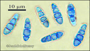 Attēlu rezultāti vaicājumam “Opegrapha atra”