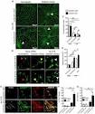 Frontiers | Fractalkine Signaling Attenuates Perivascular ...