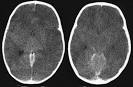 Radiology In Ped Emerg Med, Vol 5, Case 6