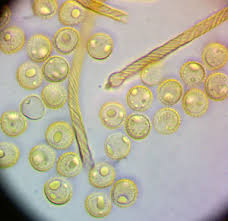 Attēlu rezultāti vaicājumam “Hemitrichia lutescens”